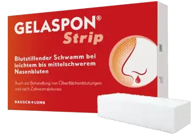 Nosebleeds in children, nosebleed, hemostasis, tooth extraction, GELASPON Strip