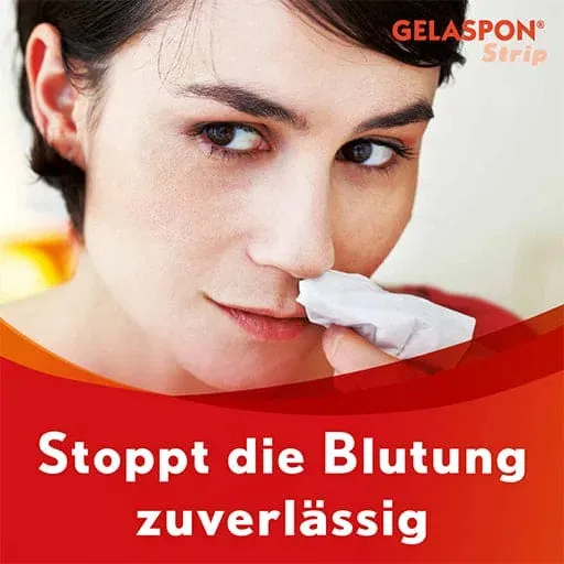 Nosebleeds in children, nosebleed, hemostasis, tooth extraction, GELASPON Strip